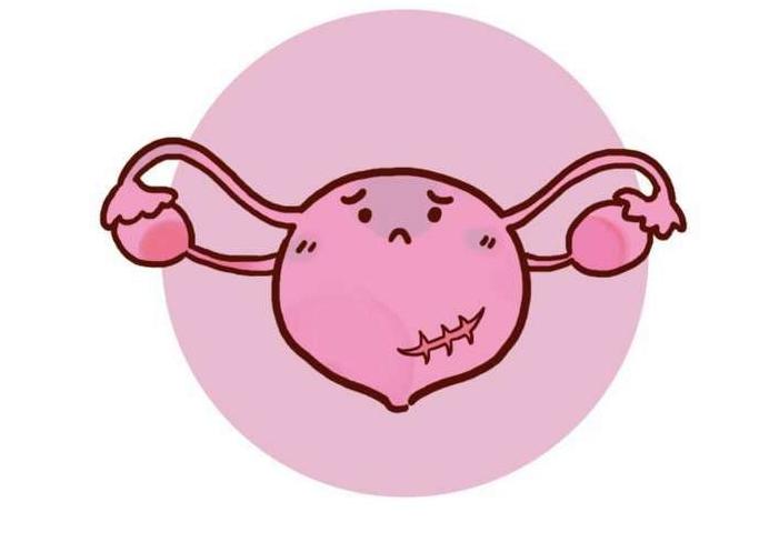 人流不全的症状有哪些？